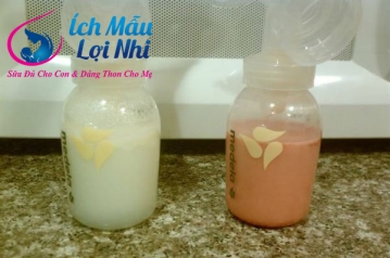 Hốt hoảng khi thấy trong sữa mẹ có máu: có nguy hiểm không?