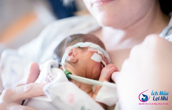 Bé sinh non có thể sẽ “thiệt thòi” hơn vì sữa mẹ về chậm