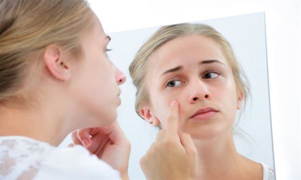 Mẹ bầu bé trai dễ bị nổi mụn 
